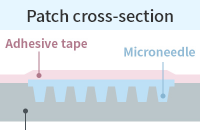 Microneedle patch cross section image